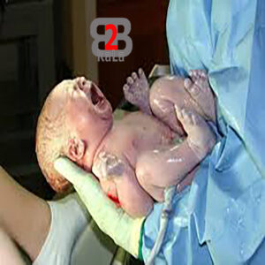 انواع سندروم مرگ ناگهانی نوزادان