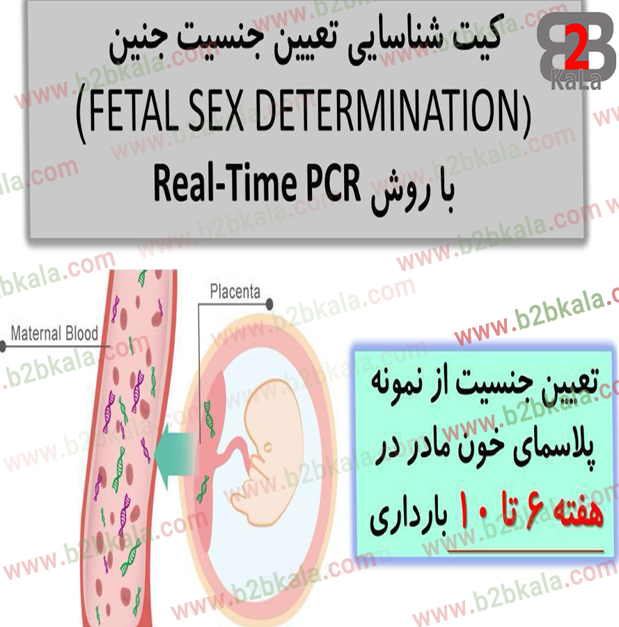 کیت تشخیص تعیین جنسیت با روش Real-Time PCR